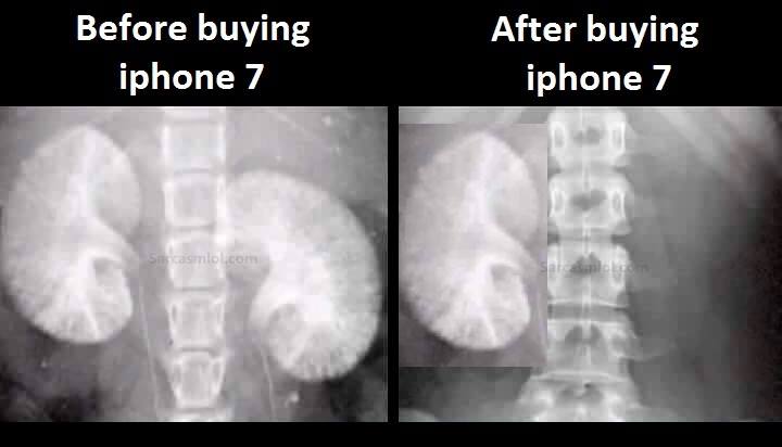iPhone7-before-after.jpg
